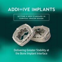 Additive Implants logo