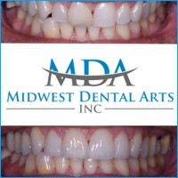 Midwest Dental Arts, Inc logo