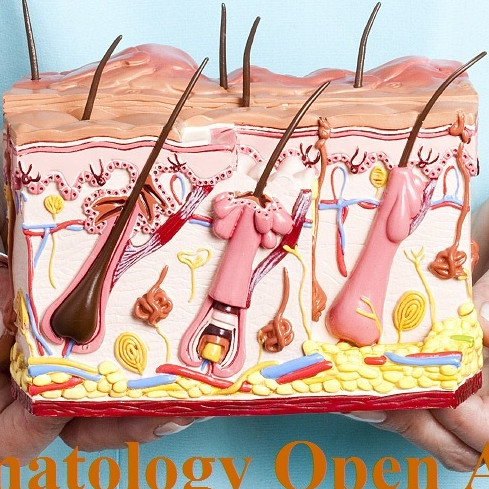 Clinical Dermatology Open Access Journal