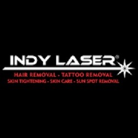 Contact Indy Laser